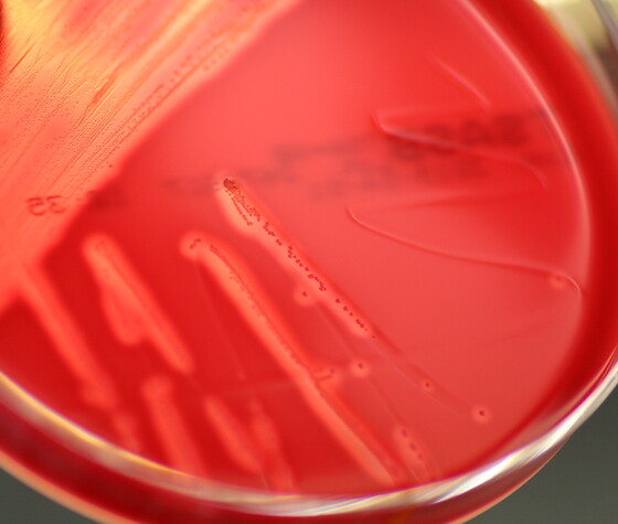 Wie werden Tierkrankheiten diagnostiziert? – Besuch im Bakteriologielabor, © LGL
