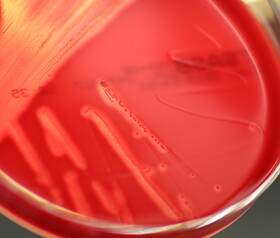 Besuch der Bakteriologie und Virologie: Wie werden Tierkrankheiten diagnostiziert?, © LGL