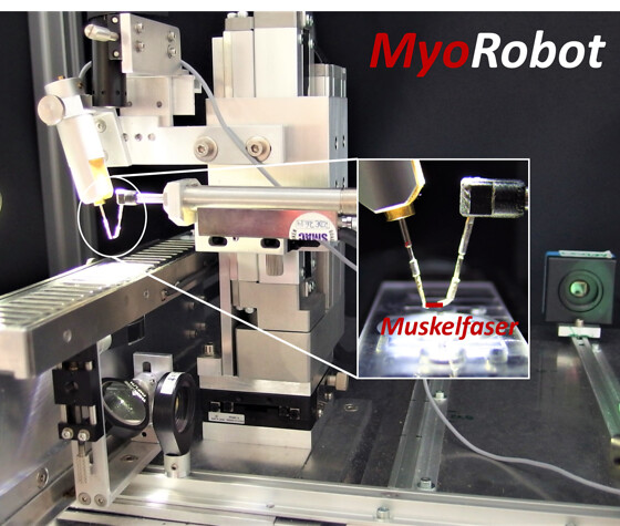 MyoRobot - Roboter spürt Muskelerkrankungen auf, © MBT